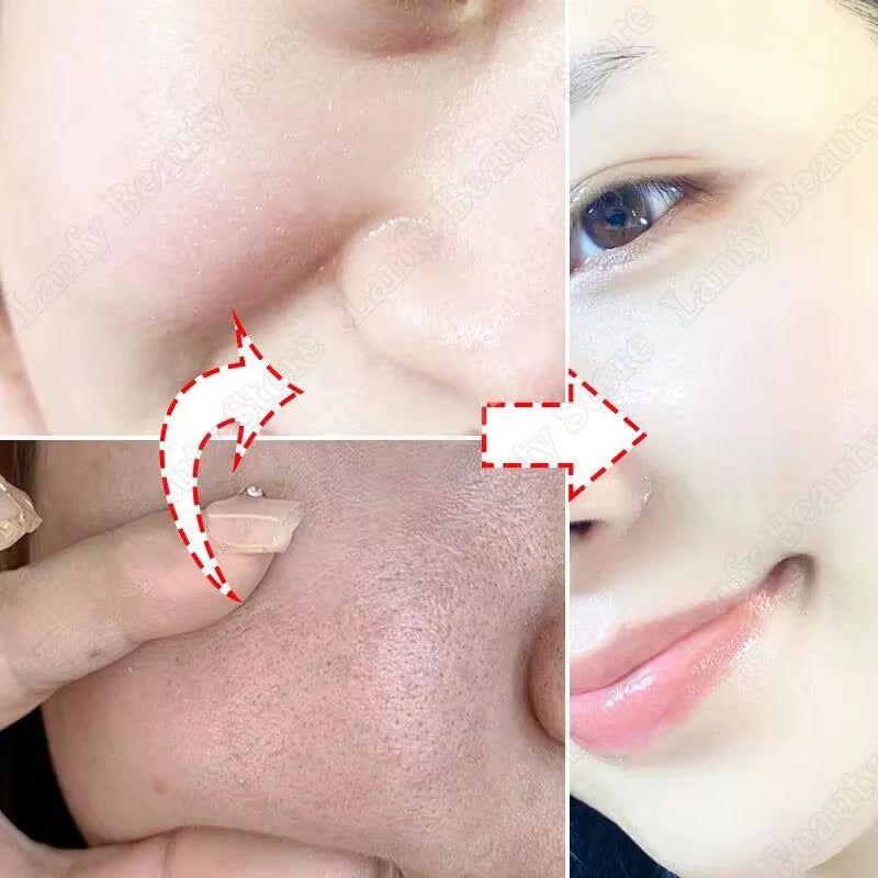 Salicylic Acid Pore Clearing Cream Shrink Pores Remove Blackheads Acne Brighten Moisturizing Smooth Skin Care Korean Products